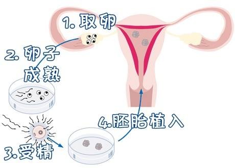 拉拉供卵服务微信群